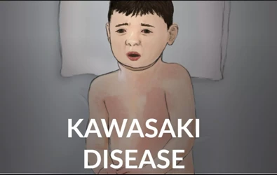Kawasaki Hastalığı Sendromu Nedir? Belirti Tanı ve Tedavi Yöntemleri
