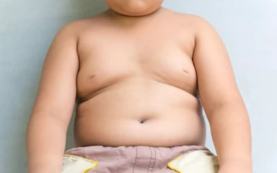 Çocuklarda Obezite Nasıl Teşhis Edilir? Tedavi Yöntemleri Nelerdir?