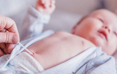Bebekelerde Göbek Kordonu ve Göbek Bağı Bakımı