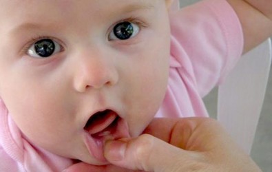 Bebeklerde Ağız Yaraları Neden Olur ve Nasıl Geçer?