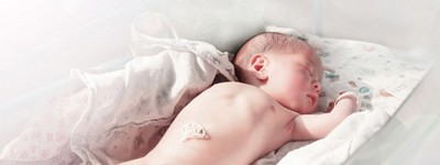 Bebeklerde Göbek Fıtığı: Tanımı, Belirtileri ve Tedavisi