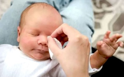 Bebeklerde Göz Çapaklanması Oluşumu ve Temizlenmesi