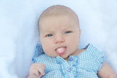 Bebeklerde Pamukçuk Nedir, Pamukçuk Tedavisi Nasıl Yapılır