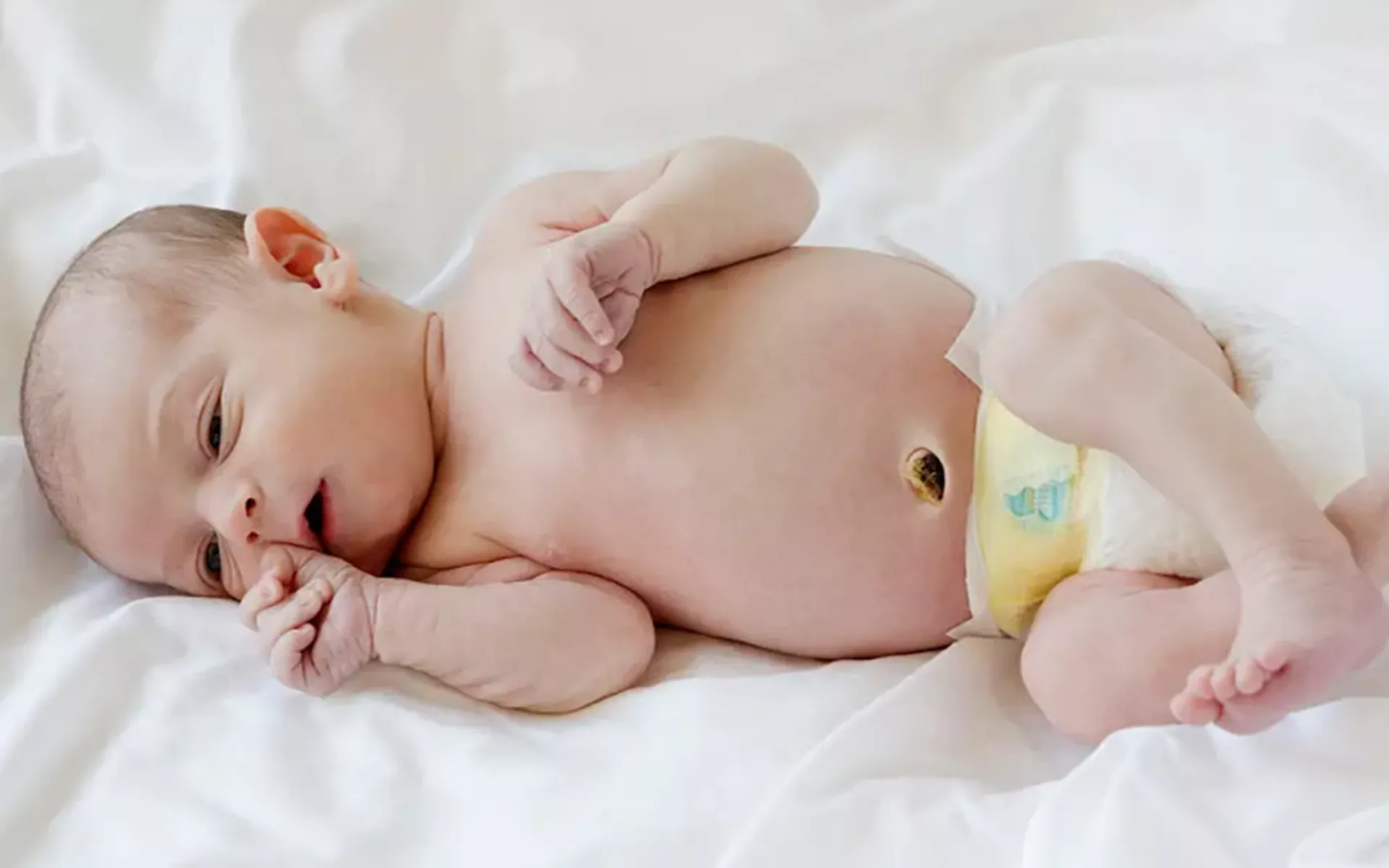 Yenidoğan Bebeklerde Göbek Kordon Bakımı